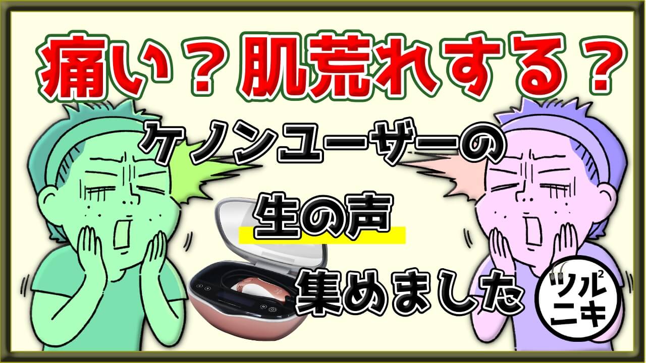 家庭用脱毛器ケノンは痛い？肌荒れしない？市場の声を集めました！